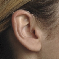 Beltone Promise 17 78DW